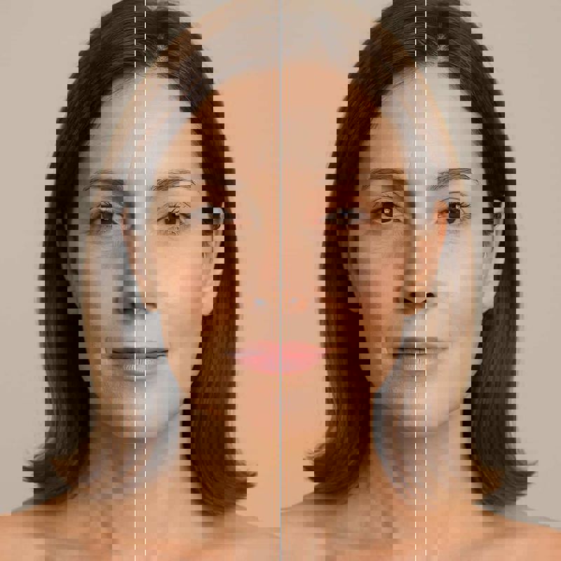 Simply Fresh Anti-Aging Treatment
